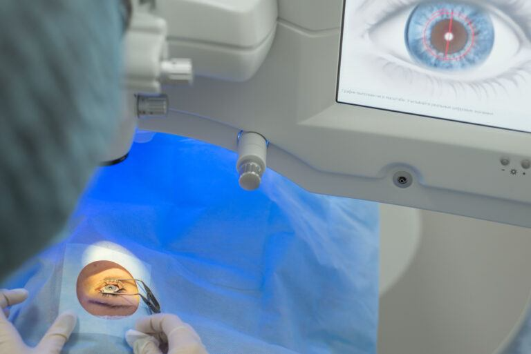 Doctor treating cataracts in the lab