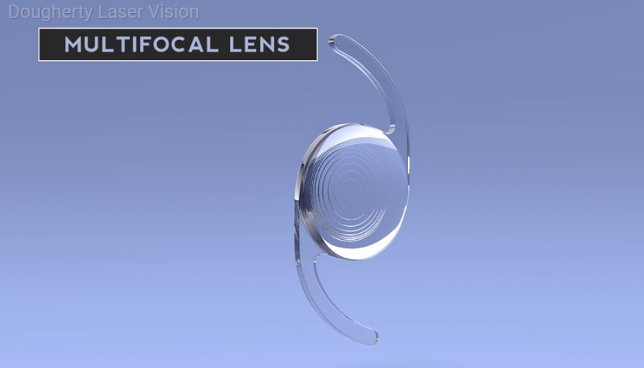 Multifocal-IOLs