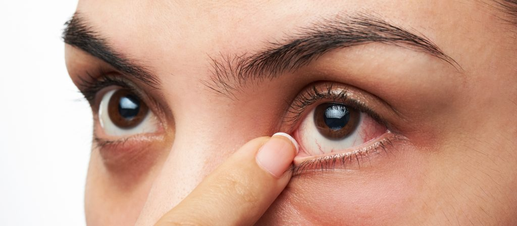 woman holding open her eye with her finger