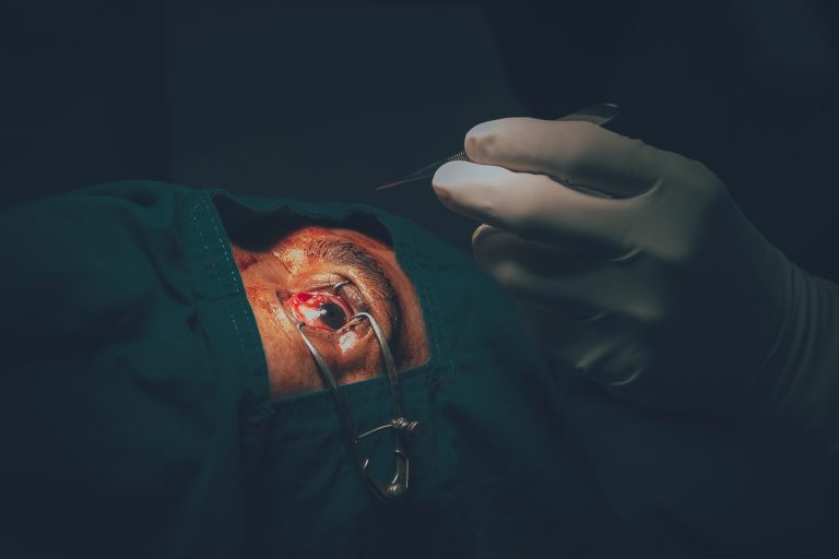 Man undergoing pterygium operation