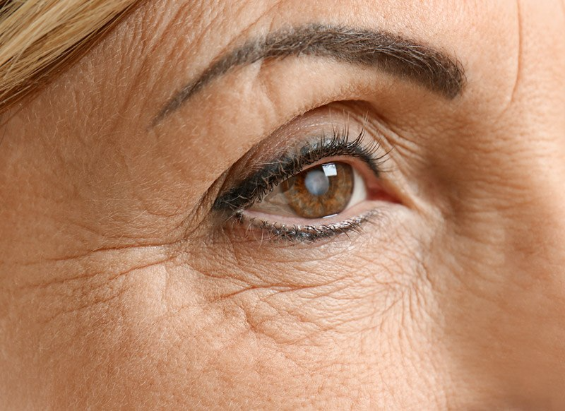 cataract prevention for elderly