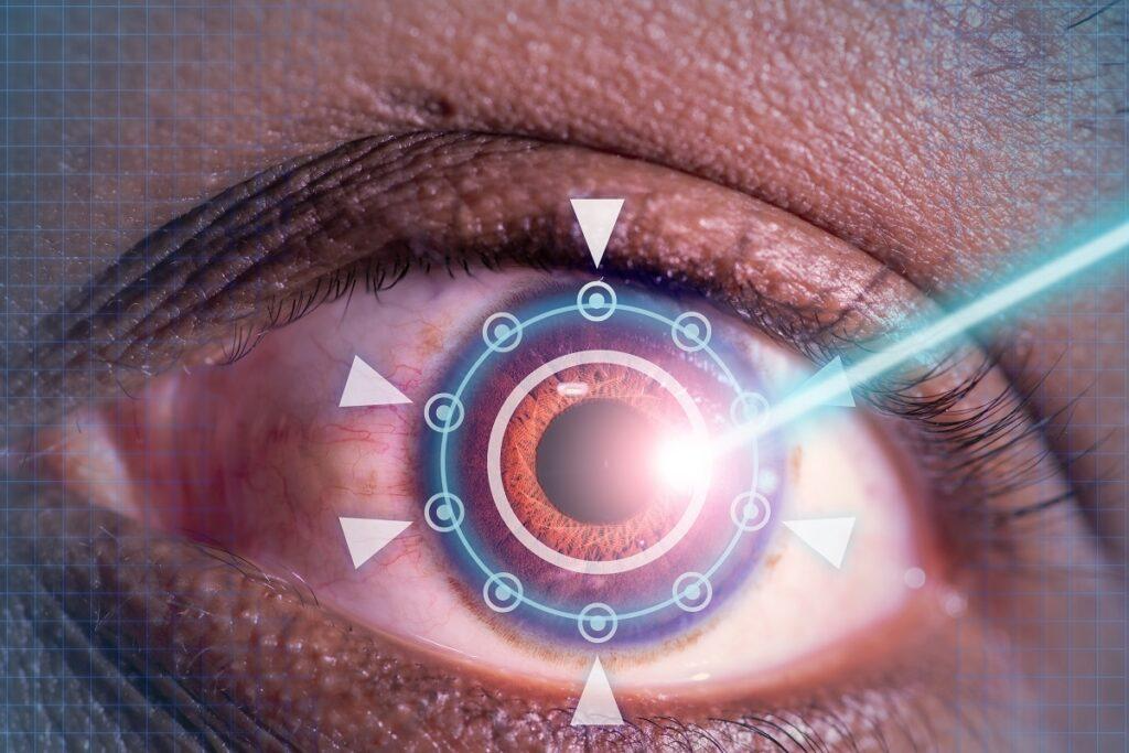 Dougherty Laser Vision Explains Difference Between LASIK and SMILE