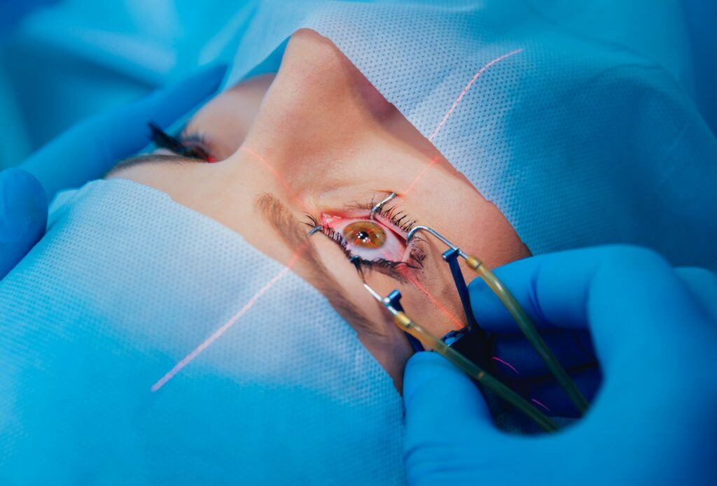 patient and team of surgeons in the operating room during ophthalmic surgery