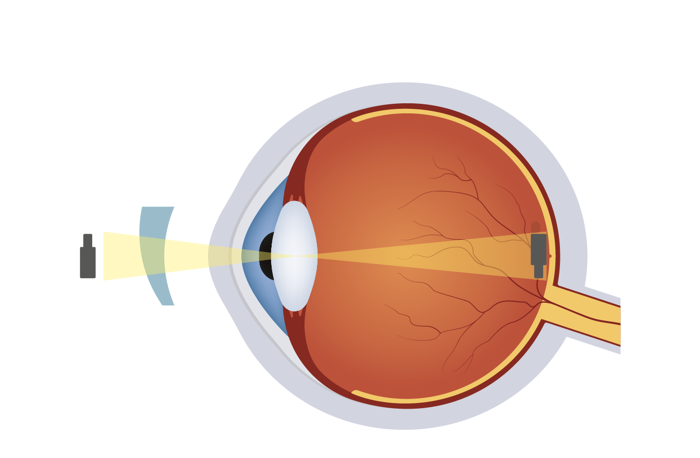 astigmatism-feature-image