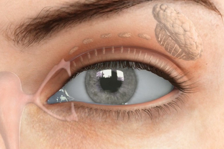 close-up image of an eye with dry eye