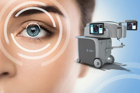 LENSAR Robotic Cataract Laser Surgery | Now at DLV Vision