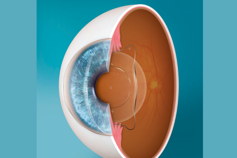 male patient under eye vision examination